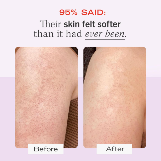 First Aid Beauty - KP Bump Eraser Body Scrub
